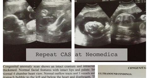 what is cas ultrasound|Everything You Need to Know About Congenital .